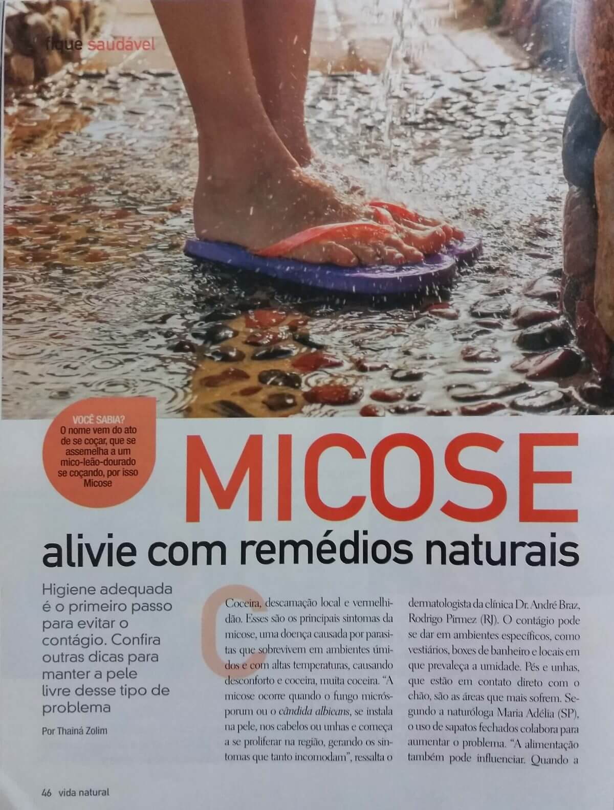 Micose, alivie com remédios naturais • Revista VIDA NATURAL